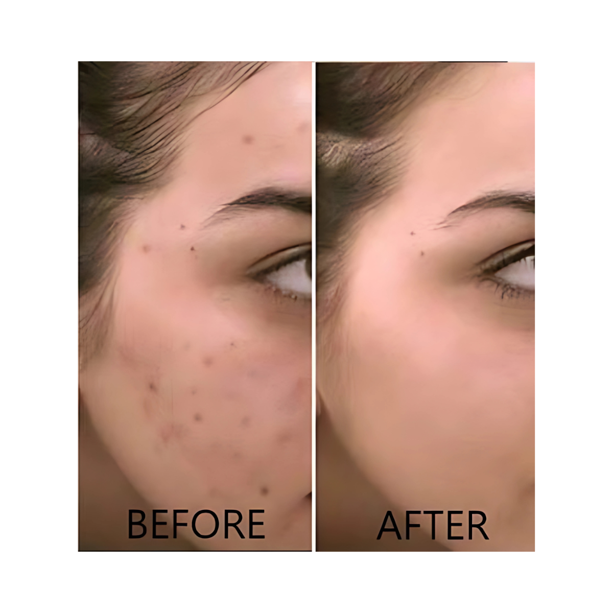 Dr. Brenner Vitamin C Serum 20% with Ferulic Acid, Vitamin E & Hyaluronic Acid – 1oz