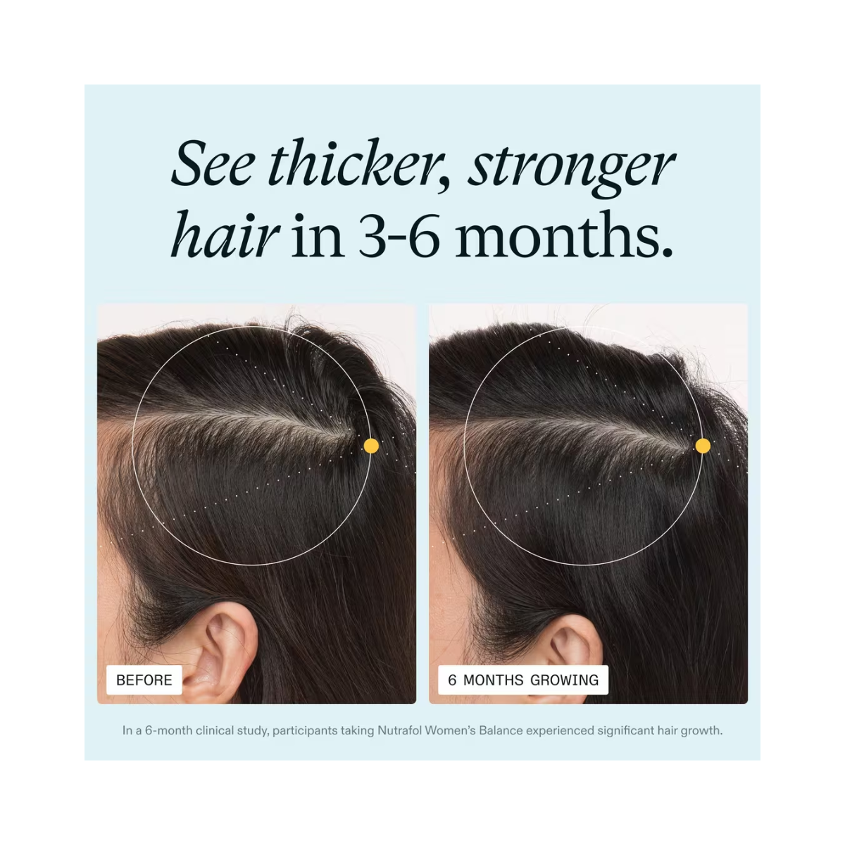 Nutrafol Women’s Balance 45+ Hair Growth Supplement – Clinically Proven