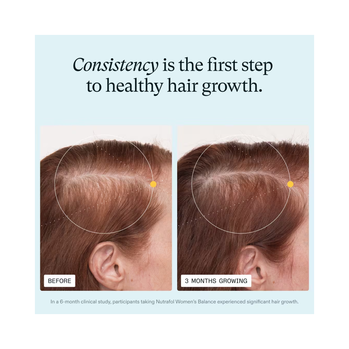 Nutrafol Women’s Balance 45+ Hair Growth Supplement – Clinically Proven