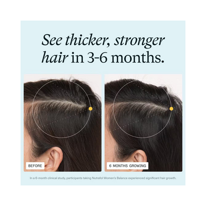 Nutrafol Women’s Balance 45+ Hair Growth Supplement – Clinically Proven