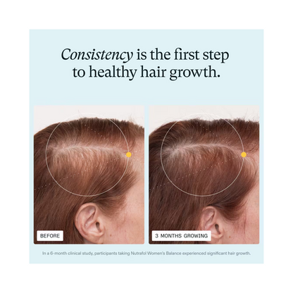 Nutrafol Women’s Balance 45+ Hair Growth Supplement – Clinically Proven