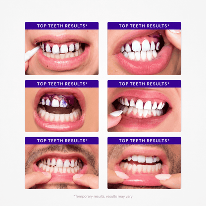 Customer reviews with before and after photos of teeth whitening results using Hismile V34 strips