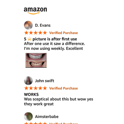 Amazon review with 5-star rating and photos of teeth whitening progress