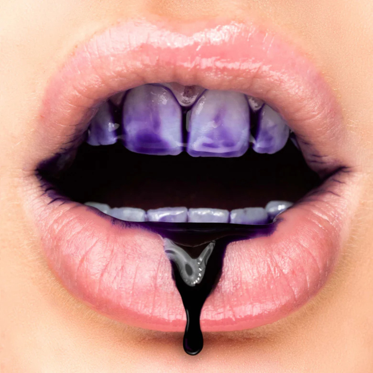 Hismile V34 Purple Teeth Brightening Serum, 1 fl oz