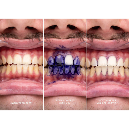 Hismile V34 Purple Teeth Brightening Serum, 1 fl oz